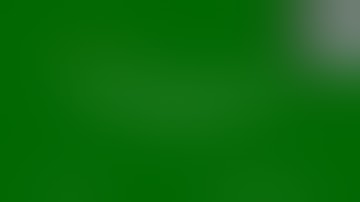 Laparoscopic Nephrectomy for Lt Ectopic Pelvic NFK-FULL video