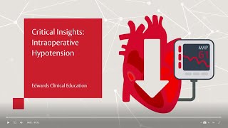 Critical Insights: Intraoperative Hypotension