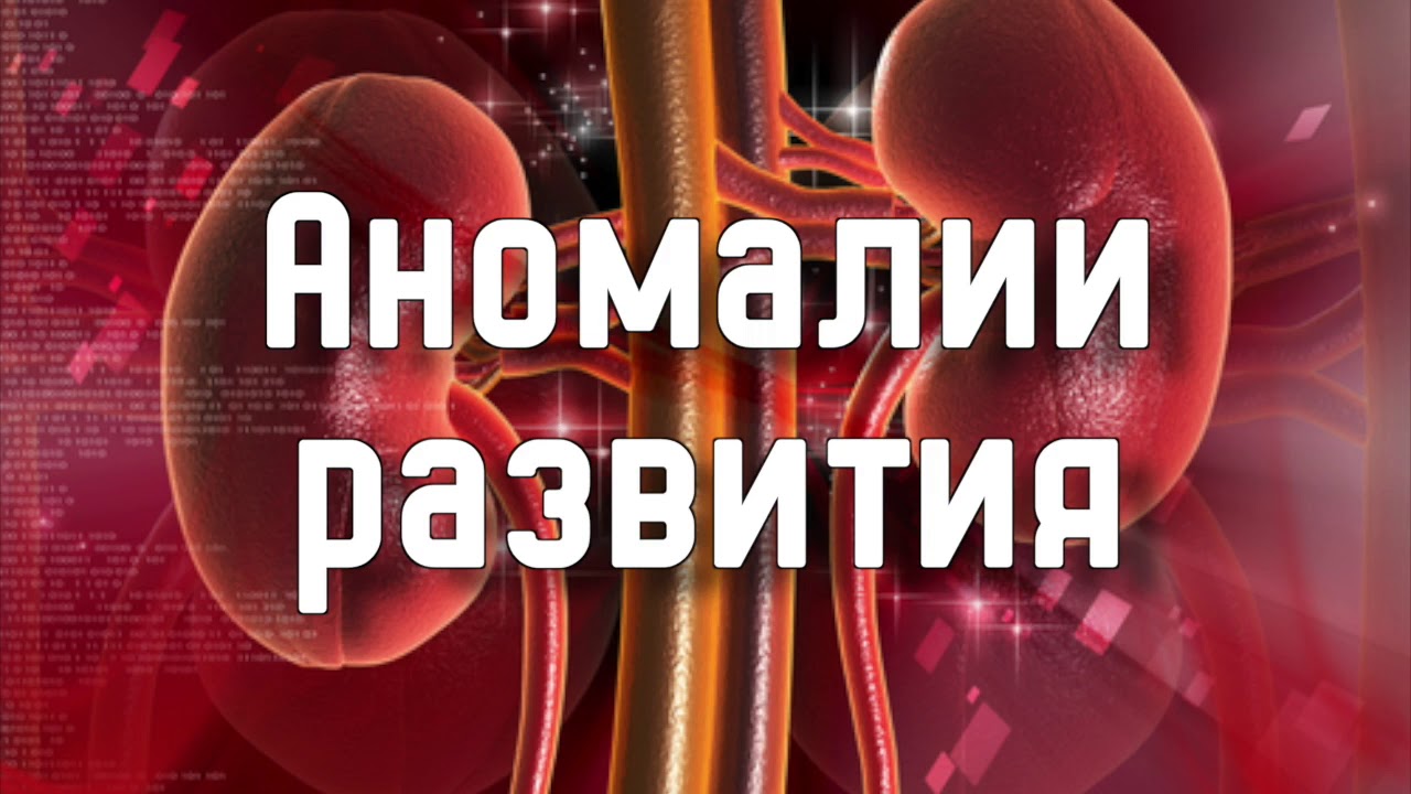 Почка. Аномалии развития.