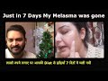 My Melasma was gone in just 7 days. लाखों रुपये लगाए पर आपकी Diet से झाँइयाँ 7 दिनों में चली गयी