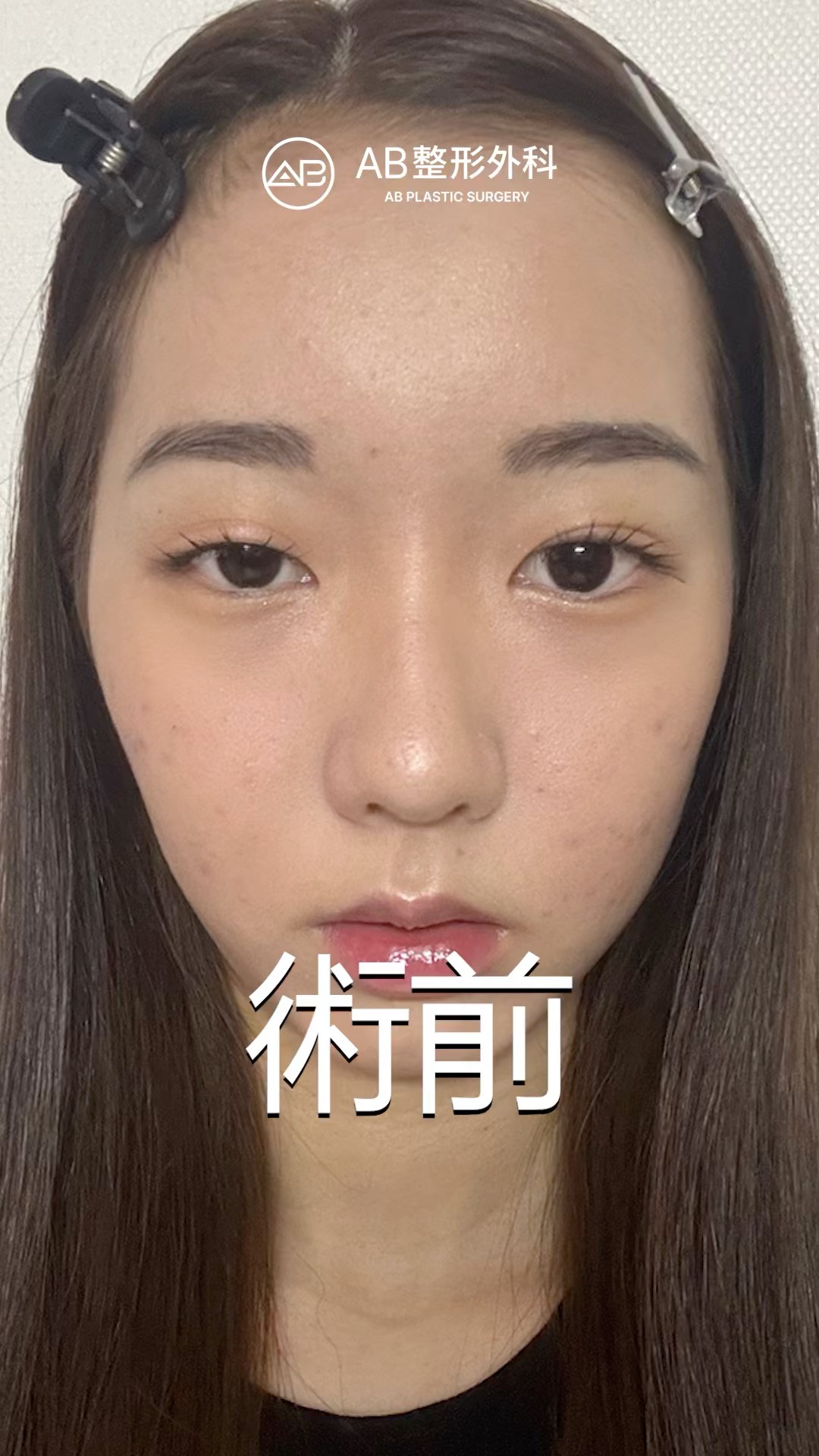 自然又漂亮的韓式雙眼皮 #shorts