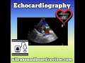 Ultrasound Board Review on Mitral Regurgitation Board Question