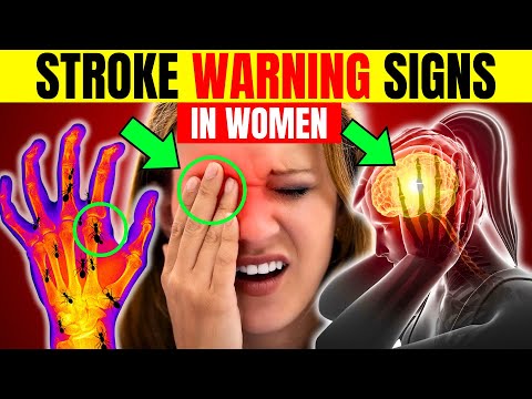 7 Warning Signs of Stroke in Women (Detect it Quickly) || HealthQuest