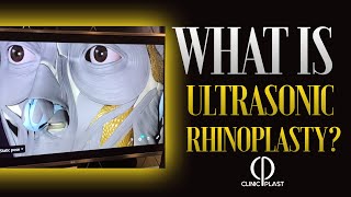 ClinicPlast I What is Ultrasonic Rhinoplasty? And Why is it more advantageous?