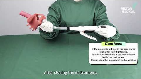 The proper use of single use circular stapler