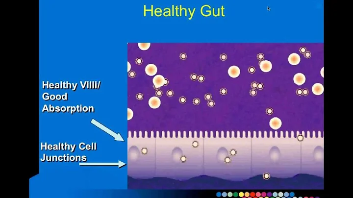 The Gut as a Portal to Your Health! Presented by P...