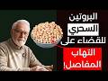 أفضل 3 مصادر بروتين نباتي لتخفيف آلام التهاب المفاصل بسرعة مذهلة