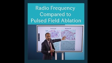 REVOLT Ep. 7: Radio Frequency vs Pulsed Frequency Ablation