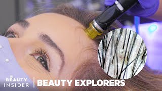 Remove Scalp Gunk With HydraFacial Keravive | Beauty Explorers