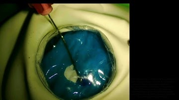 A Cost-Effective Simulation Model for CCC - Supplementary video 5 [ID 378298]