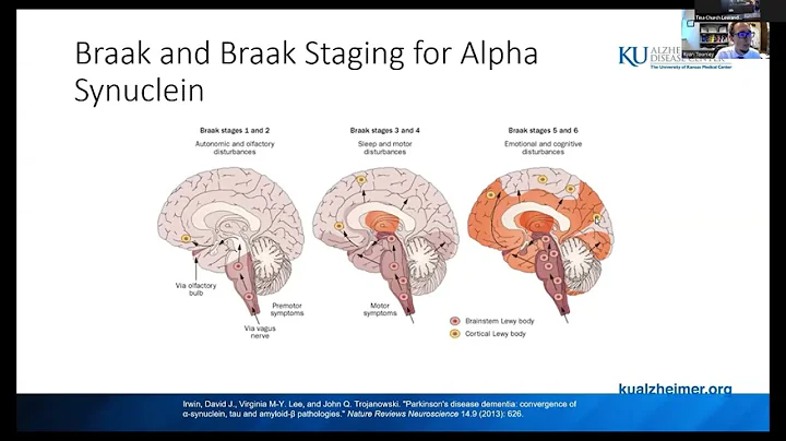 WEEKLY WEBINAR: Dementia with Lewy Bodies - 10/6/22