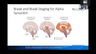 WEEKLY WEBINAR: Dementia with Lewy Bodies  10/6/22