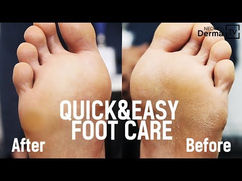 removing dead skin cells from foot｜TikTok Search