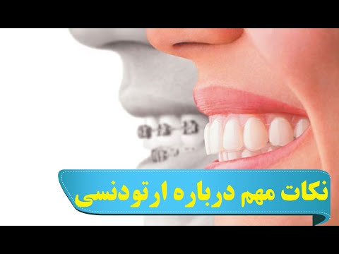 تصویری: آیا بریس‌ها برای گذاشتن آنها ضرر دارد؟