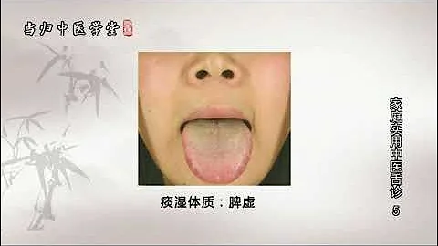 罗大伦 家庭实用中医舌诊 第5讲 罗大伦《家庭实用中医舌诊》 罗博士图解舌诊 痰湿体质舌象 - 天天要闻