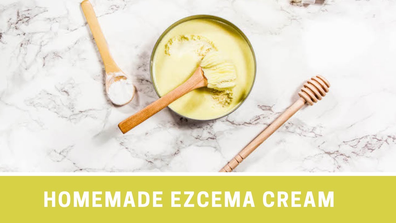 Homemade Eczema Cream Recipe With All Natural Ingredients YouTube Maxresdefault