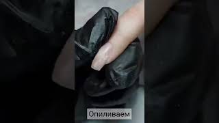 Поднимаем клюющий ноготь