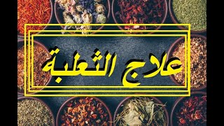 علاج الثعلبة في 7 ايام    مكونين فقط و وصفة مجربة 2020