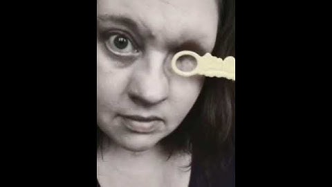 Woman Discovers Unusual Ability to Blow Bubbles With Her Eye Socket After Eye Removal - 1173396-1