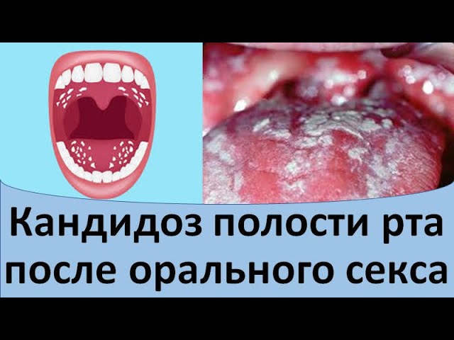 Непростая мужская проблема... Непростая мужская проблема...
