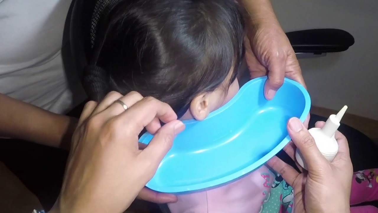 Little Girl's Hard & Dry Earwax Removal