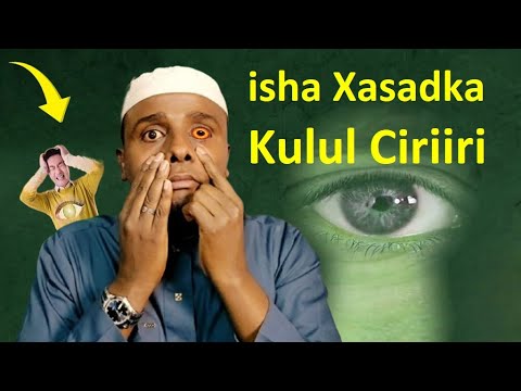 Halista Isha Xasadka Jirkaada Kujirta Sunta Ay Wadato Siday Qofka Ka Dhigto Halista Isha Xasadka Jirkaada Kujirta Sunta Ay Wadato Siday Qofka Ka Dhigto