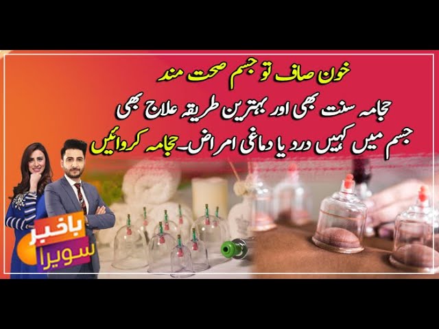 Hijama Points for Varicocele