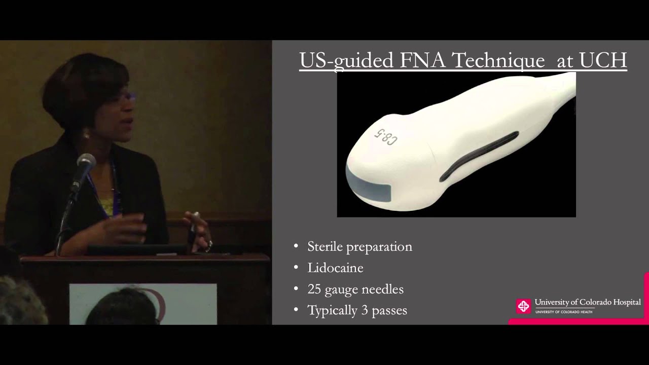 Thyroid Cancer: Ultrasound for Nodules, Current Guidelines. Dr. McKinney. ThyCa Conference