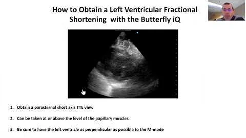 How to Obtain a Left Ventricular Fractional Shortening with the Butterfly iQ