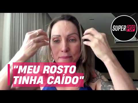 Vítima de complicação estética faz relato impressionante: "Meu nariz despencou"