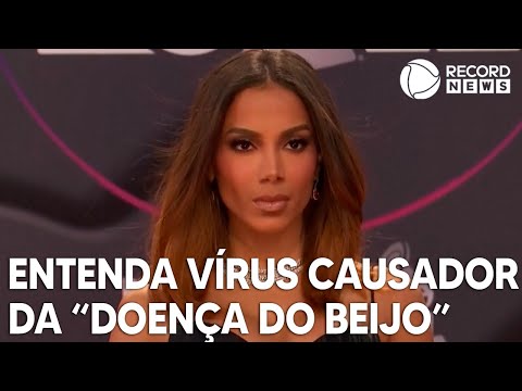 "Doença do Beijo": entenda diagnóstico revelado por Anitta