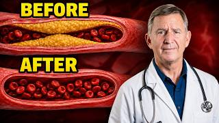 The #1 Food for Artery Plaque, According to Science