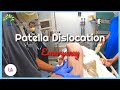 Patella Dislocation Emergency