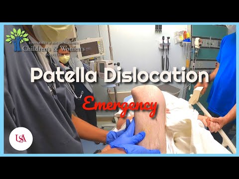 Video: Kneecap Dislocation Hos Katte