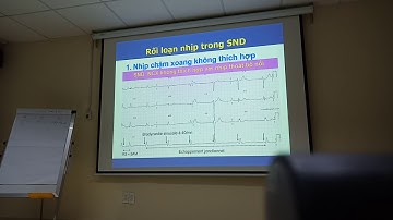 HC Suy nút xoang  2 BS Sỹ