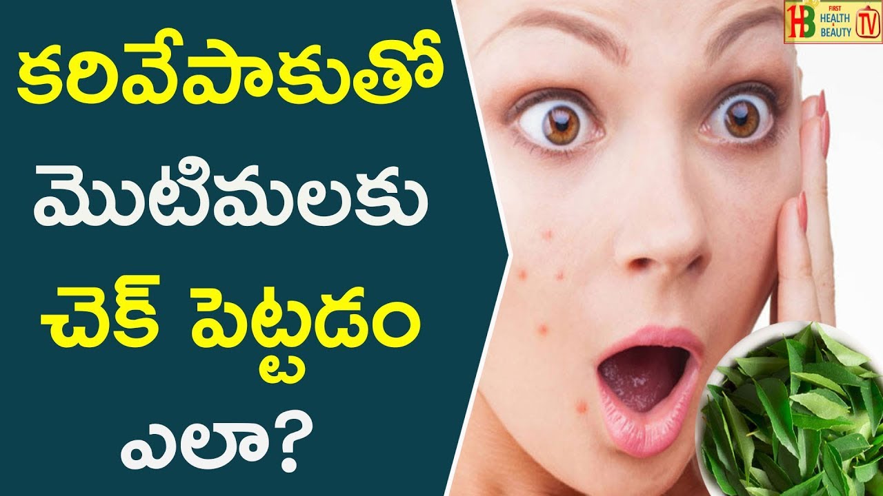కరివేపాకుతో మొటిమలకు చెక్ పెట్టడం ఎలా? || How To Get Rid Of Pimples & Dark Spots With Curry Leaf? beautycon