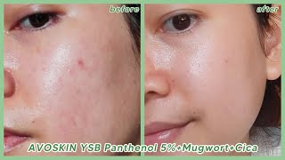 AVOSKIN YSB PANTHENOL 5%   MUGWORT   CICA — serum ampuh untuk mengatasi kemerahan dan iritasi