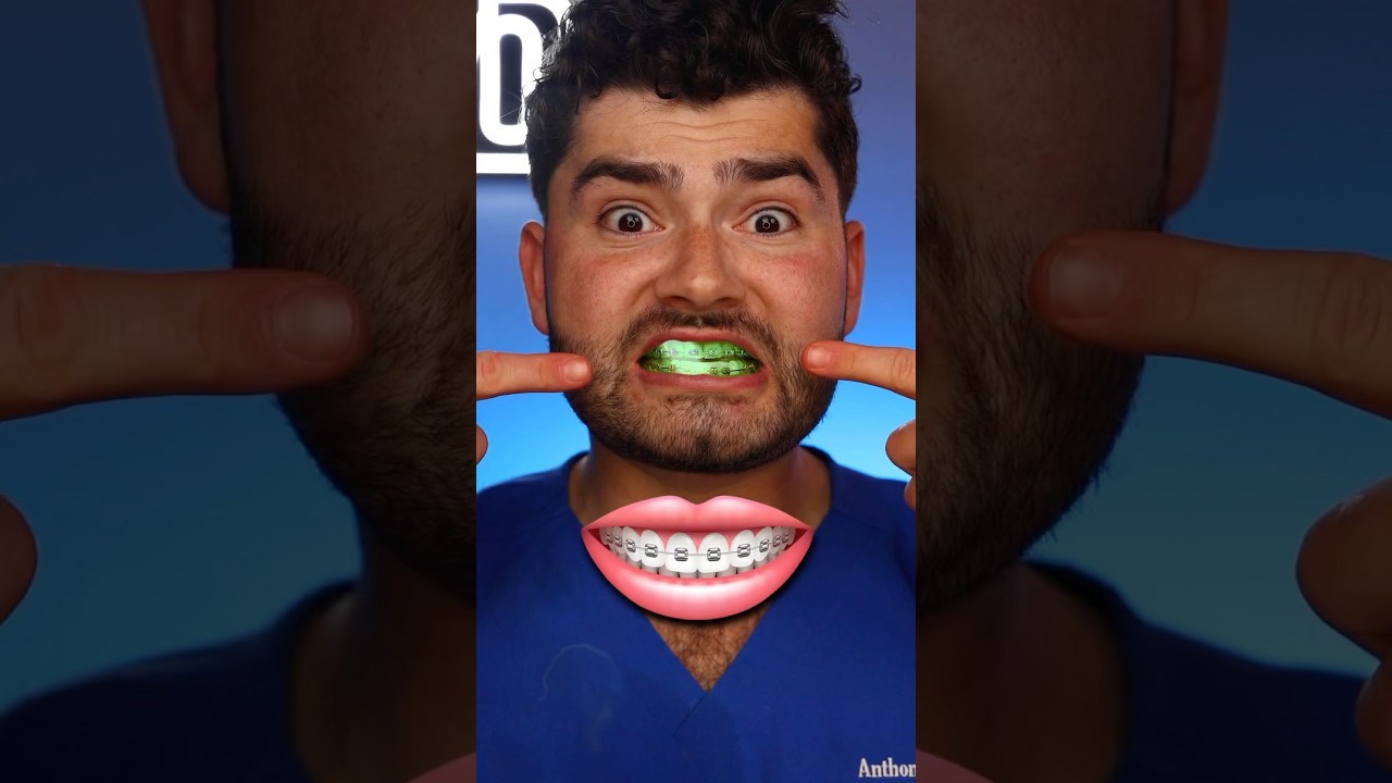 what’s the best BRACES color!? 🔴🟢🔵