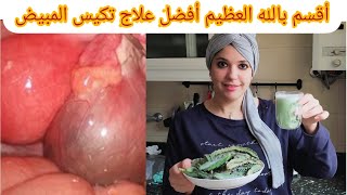 #_مشروب_تسريع_الحمل_عشبة_الدغموس_لعلاج تكيس المبايض أقسم بالله العظيم أفضل علاج طبيعي لكيس الرحم