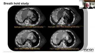 RTUK Talks: Dr Cozzi - Adopting Adaptive 27/09/2023