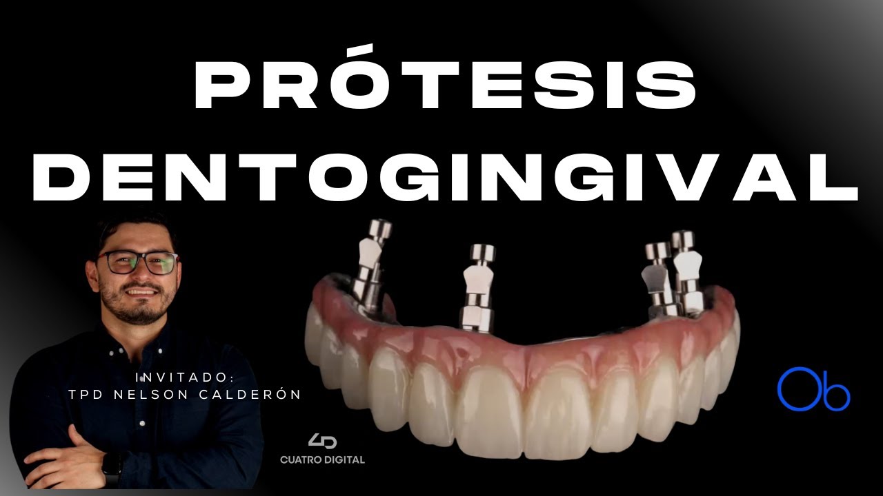 Prótesis Dentogingivales con TPD Nelson Calderón