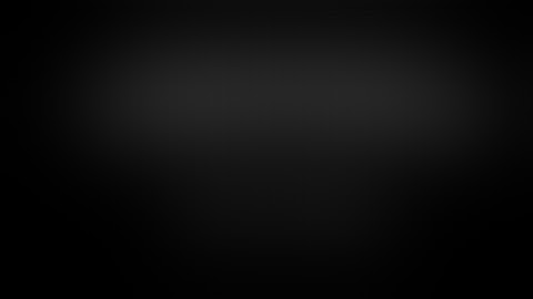 Transparotid Dissection for Condylar Neck fractures