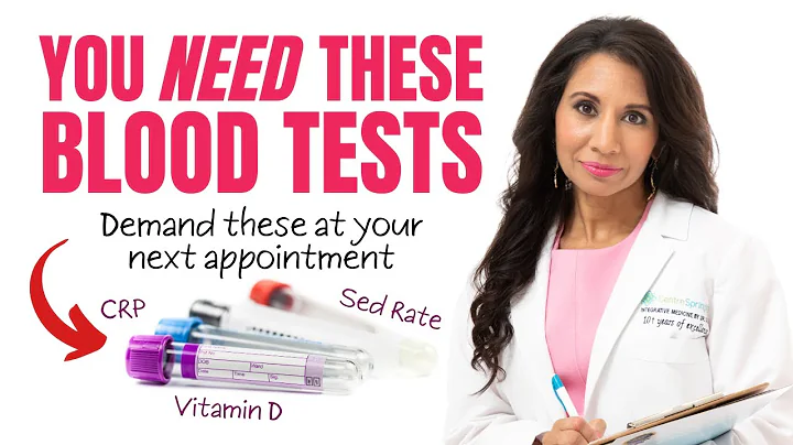 Which Blood Tests Should I Ask For? Ask Your Doctor for These Tests
