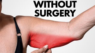 How to Get Rid of Bat Wing Arms Forever… (in 60 Days)