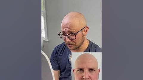 Amazing SMP results on a Client with blonde hair by Anthonye