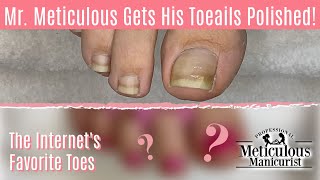 👣Ingrown Toenail & Impacted Toenail Pedicure: Relief, Causes and Prevention👣