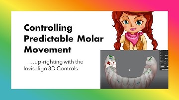 Invisalign ClinCheck - Uprighting molars with 3D controls