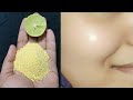 दिन में बस 1 बार लगाके देखो चेहरा इतना गोरा बेदाग खूबसूरत बना देगा | get clear skin |  spotless skin