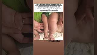 Never Compare Your Baby❌👶 |EveryChildGrowsDifferently #BabyGrowth#ParentingTips #NewbornCare#MomLife