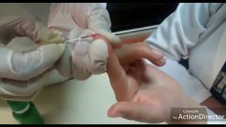 De técnica de sangre capilar extracción